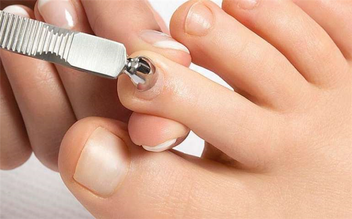 Зачем нужны кусачки для педикюра?