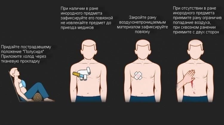 Открытые раны в области грудной клетки, в том числе ножевые, могут проникать в плевральную полость, пропуская воздух или кровь, что может привести к коллапсу легкого или гемотораксу. В этих случаях требуется немедленное медицинское вмешательство, чтобы предотвратить развитие угрожающих жизни состояний.